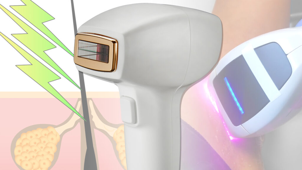 Aesthetic Skin Chicago -Laser Hair Removal -Device - Diolaze