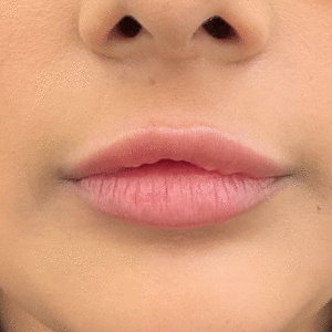 lips- 01